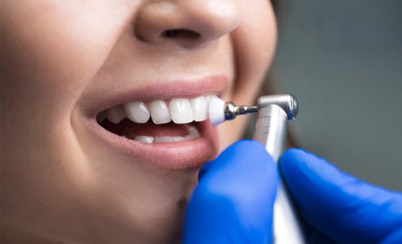 a patient getting teeth cleaning in Rockwall