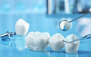 A dental bridge near implant parts against a blue background