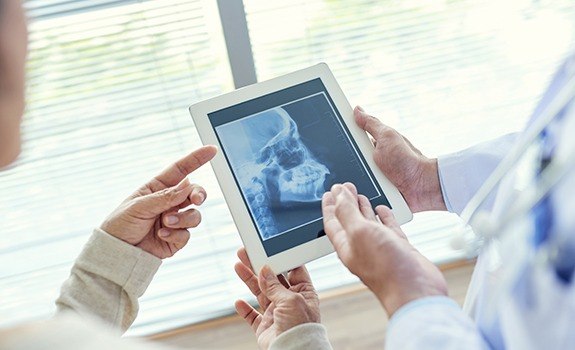 Dentists examining x-rays of jaw and skull bone to plan T M J treatment