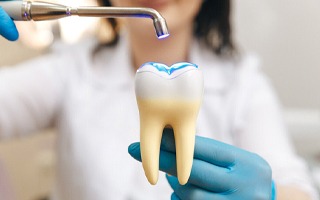 dentist in Rockwall working on tooth-colored filling