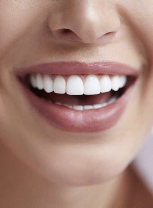 Closeup of patient’s smile after visiting their cosmetic dentist 