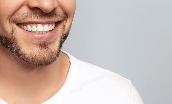 Closeup of man smiling after visiting cosmetic dentist 