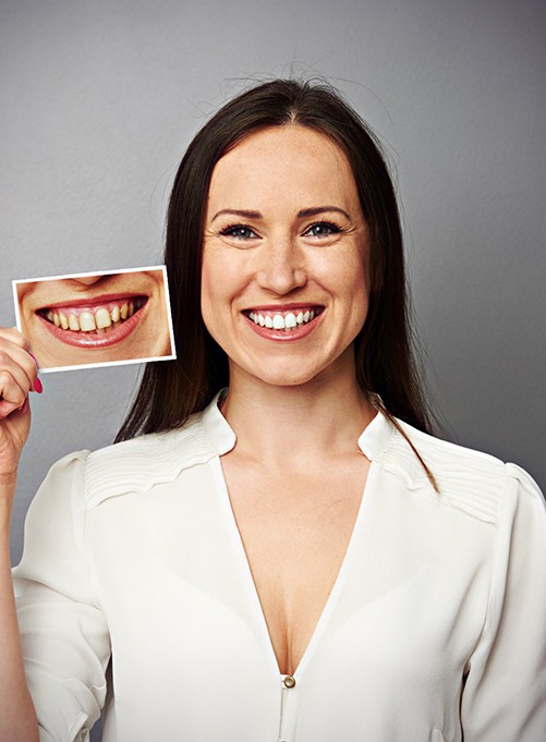 Woman holding photo compares after teeth whitening in Rockwall 